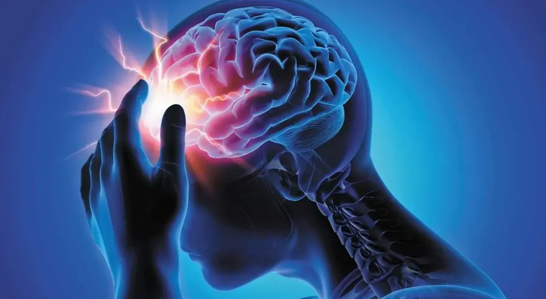 মাথাব্যথা খুবই সাধারণ একটি সমস্যা | ছবি : সংগৃহীত