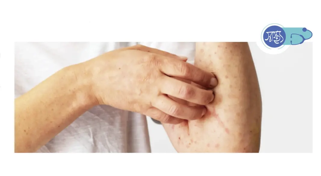 ছবি : সংগৃহীত